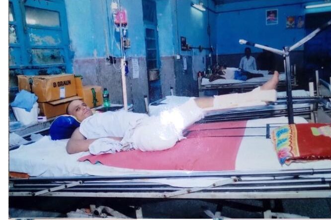 SANJEEVNI BOOTI 4: Artificial Leg